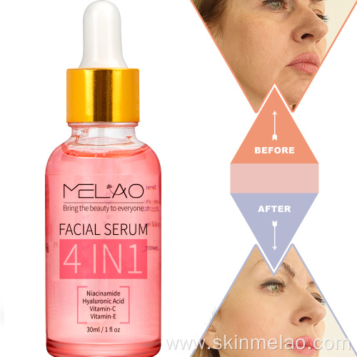 4 in 1 Whitening Face Serum